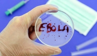 Cách phòng ngừa lây virus nguy hiểm Ebola